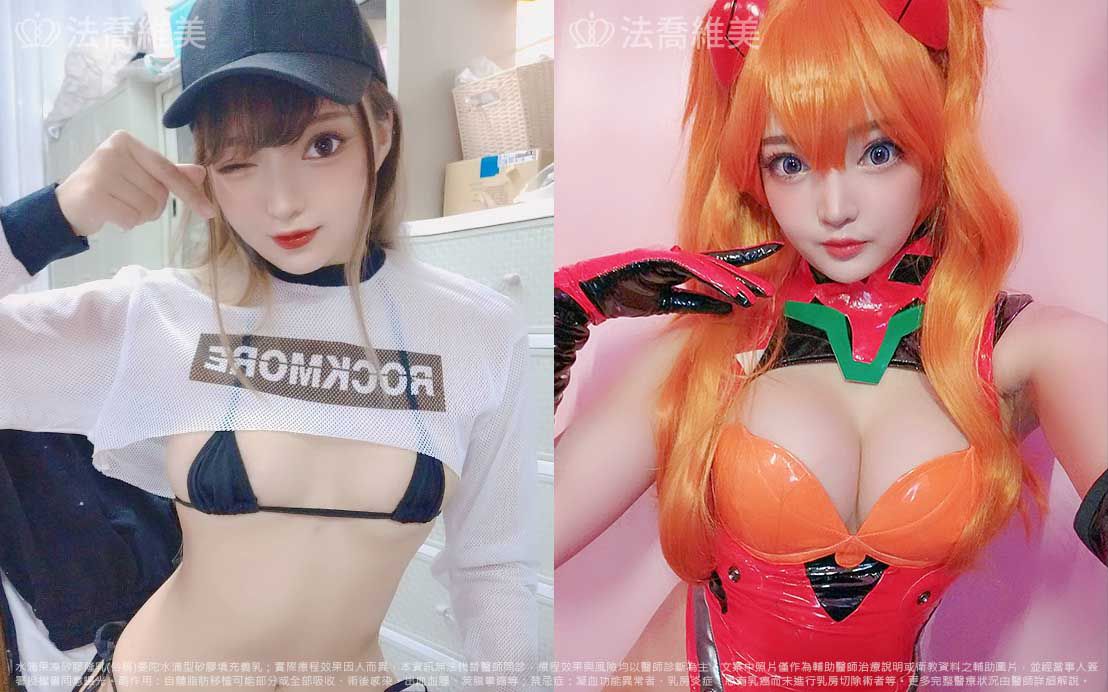 水滴型果凍矽膠隆乳,自體脂肪隆乳